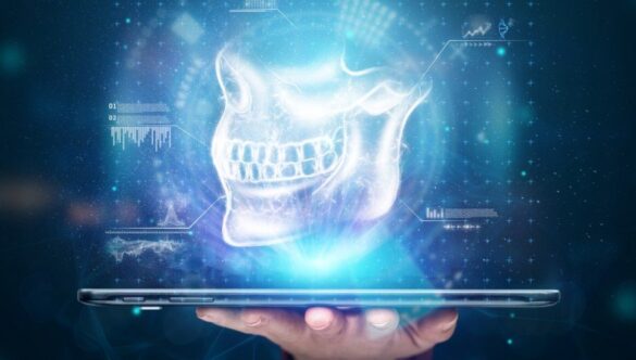 Implantul dentar se inserează perfect cu ajutorul imaginilor modulului de raze X Planmeca Romexis 3D