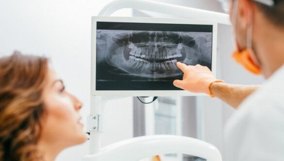 RADIOGRAFIE DENTARĂ PANORAMICĂ DIGITALĂ, PENTRU UN DIAGNOSTIC PRECIS
