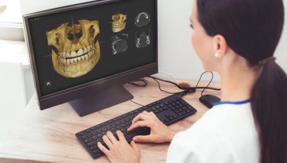 MODULUL ROMEXIS 3D DIN DOTAREA CENTRELOR YTS-DENTAL VIEW ESTE O UNEALTĂ IMAGISTICĂ PUTERNICĂ