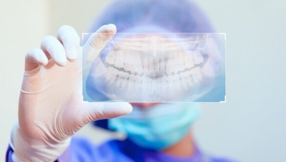 DESPRE JUSTIFICAREA RADIOGRAFIEI DENTARE, CRITERII DE REFERIRE ȘI REGLEMENTĂRILE ÎN VIGOARE