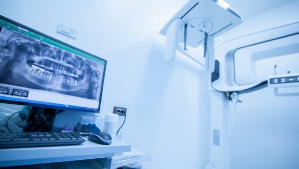 SUCCESUL YTS-DENTAL VIEW: TEHNOLOGIE, EXPERTIZA ȘI CONSTANȚA PERFORMANȚEI IMAGISTICE