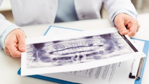 IMPLANT DENTAR OPTIM ÎN ORADEA, DOAR GRAȚIE IMAGINILOR MODULULUI DE RAZE X PLANMECA ROMEXIS 3D