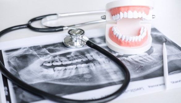 Mituri și Adevăruri despre radiografia dentară: Care este realitatea la YTS Dental View?