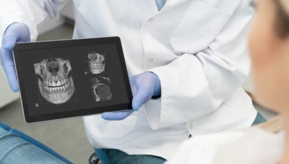 CBCT: un instrument esențial în tratamentul ortodontic și implantologic