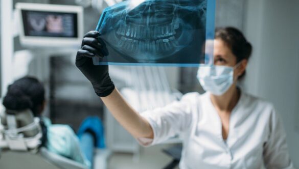 CE RIȘTI DACĂ NU FACI RADIOGRAFII DENTARE