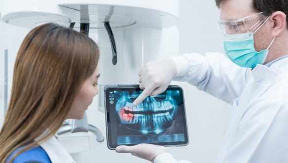 Ce fel de probleme pot fi identificate prin intermediul unei radiografii dentare la YTS Dental View?