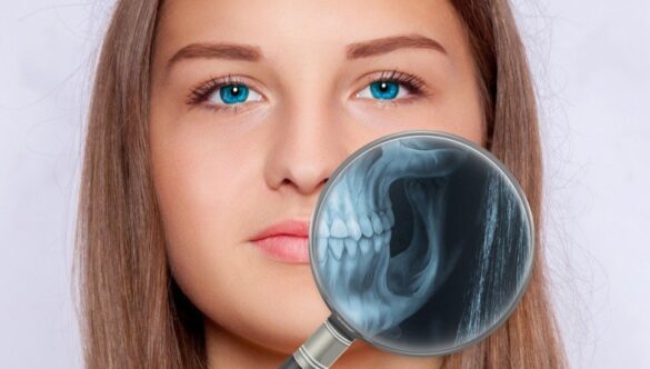 Dental View Progresului (Vulcan) – sau raportul calitate-preţ optim al serviciului radiologic denta