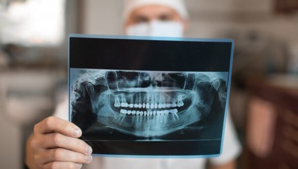 Radiografia dentară digitală, una dintre cele mai avansate metode imagistice din București