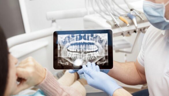 RADIOLOGIA DENTARĂ SECTOR 3, BUCUREȘTI ȘI CENTRUL EI DE EXCELENȚĂ “YTS – DENTAL VIEW”, PIAȚA MUNCII