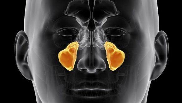 CBCT DE SINUS MAXILAR