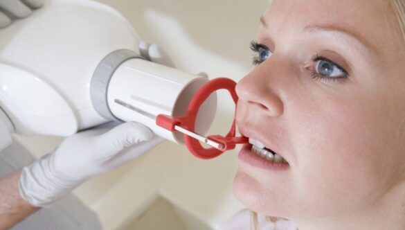 CUM SE EFECTUEAZĂ O RADIOGRAFIE DENTARĂ DIGITALĂ INTRAORALĂ?