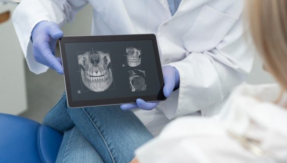 DESPRE PREGĂTIREA PENTRU – ȘI REALIZAREA UNEI TOMGRAFII DENTARE