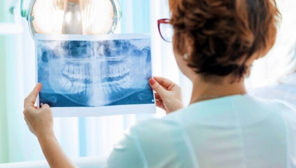 10 SITUAȚII ÎN CARE TREBUIE NEAPĂRAT SĂ FACEM RADIOGRAFII DENTARE