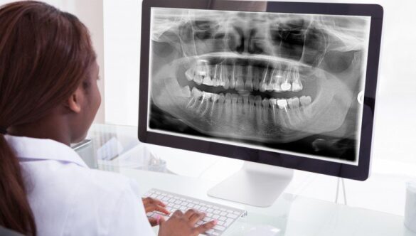 Riscurile amânări unei radiografii dentare