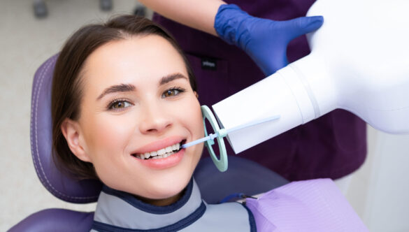 CUM SE EFECTUEAZĂ O RADIOGRAFIE DENTARĂ DIGITALĂ INTRAORALĂ?