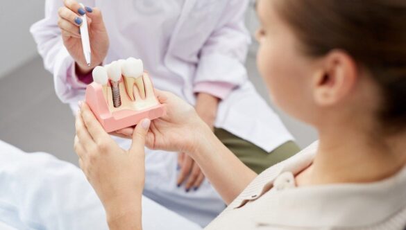 RISCURILE UNUI IMPLANT DENTAR