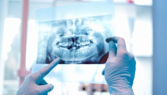 TEHNOLOGIA DE RADIOLOGIE DENTARĂ CBCT, PRIMA DIN ROMÂNIA LA CENTRUL YTS – DENTAL VIEW, PIAȚA MUNCII