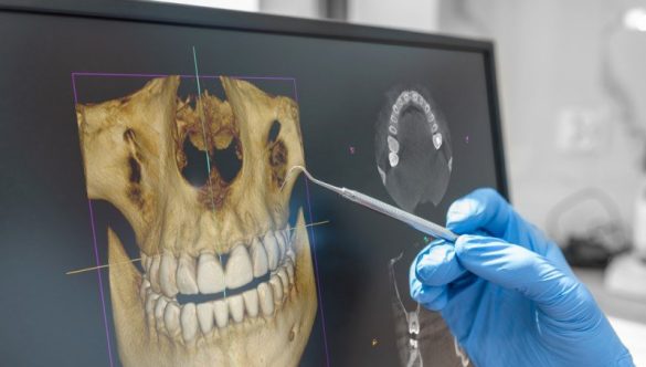 Centrul Dental View explică tehnologia din spatele tomografiei dentare (CT) și importanța acesteia