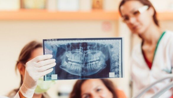 RADIOGRAFIA DENTARĂ DIGITALĂ CAPTEAZĂ IMAGINI FIDELE ALE ZONELOR OSOASE ȘI TISULARE PROFUNDE
