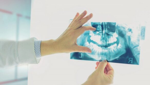 RADIOGRAFIA DENTARĂ DIGITALĂ – O FOARTE BUNĂ MODALITATE INVESTIGATORIE
