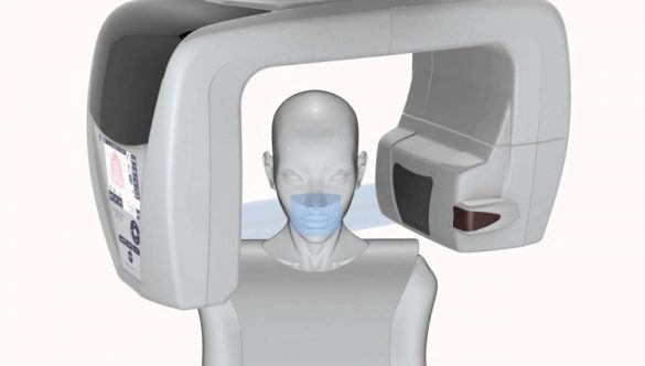 CBCT DENTAR – TEHNOLOGIA VIITORULUI