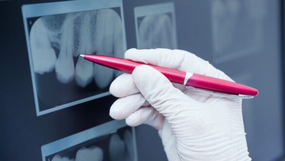 Radiografie dentară în București – O procedură care nu implică durere