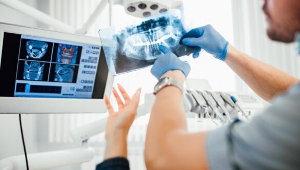 Ce complicaţii pot fi diagnosticate prin radiologia dentară?