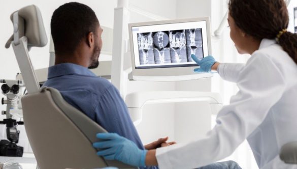De ce medicii stomatologi de la YTS recomandă radiografia dentară înainte de tratamente majore?