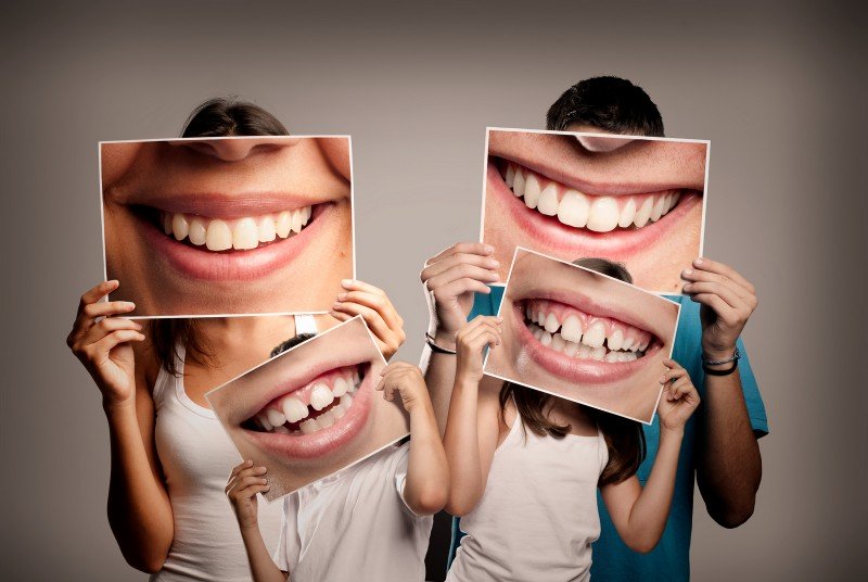 set ortotontic complet yts dental view 1