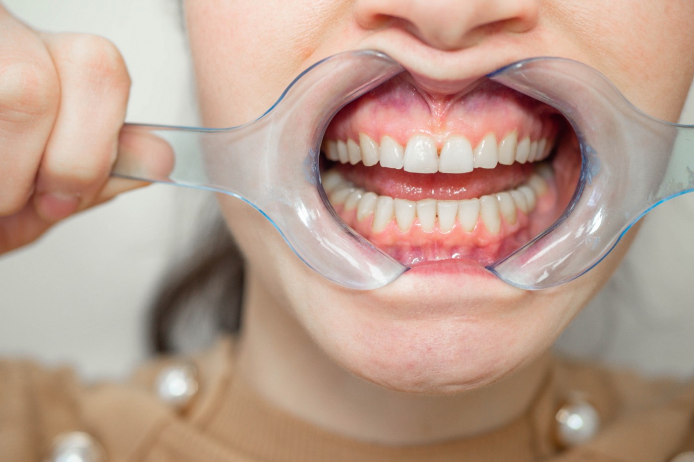 set ortotontic complet yts dental view 2