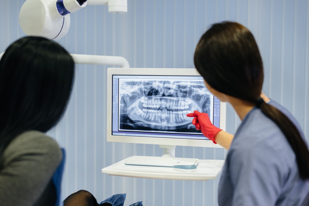 radiografie dentara Bucuresti, yts dental view